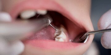 Toothache and pain attack! Get rid of this way
