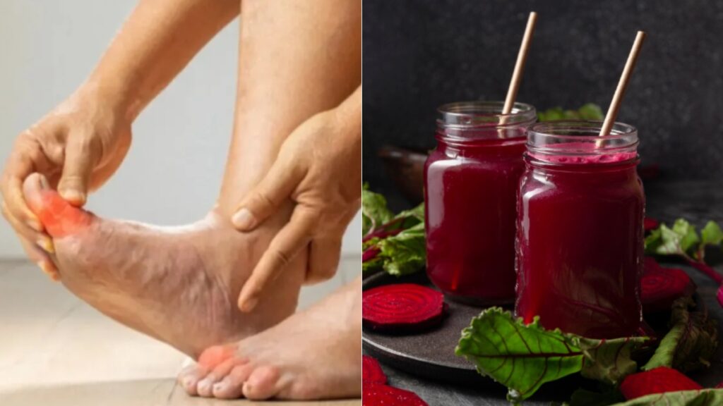 Uric acid stored in the body will come out, drink this juice full of medicinal properties daily