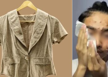 Wearing second hand clothes can be overwhelming, see what is done about this person