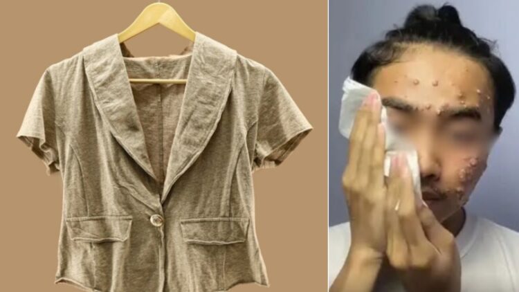 Wearing second hand clothes can be overwhelming, see what is done about this person