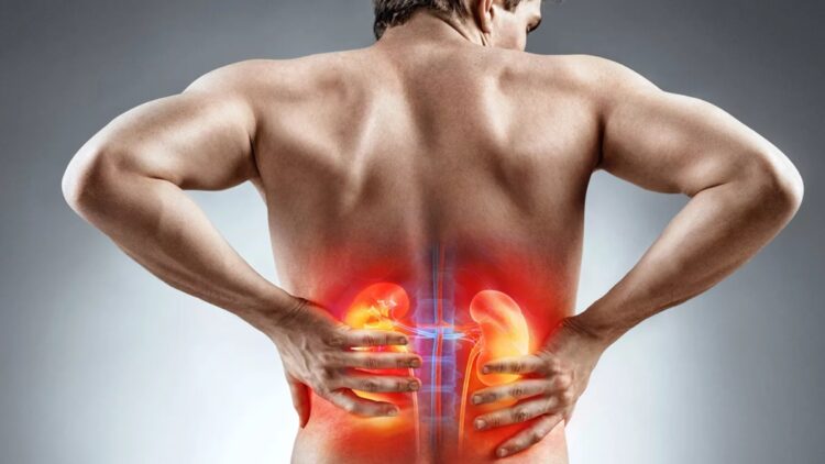 What increases in summer is the risk of kidney stone and experts are telling the solution