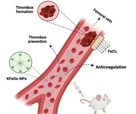 IIT-BHU scientists made nano particles preventing blood clotting