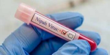 Outbreak of Nipah virus in Kerala, 425 people under surveillance
