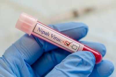 Outbreak of Nipah virus in Kerala, 425 people under surveillance
