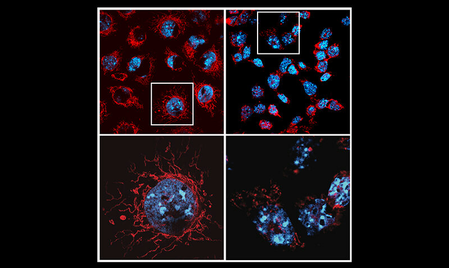 What is the reason for the side effects of cancer drugs? Research disclosure
