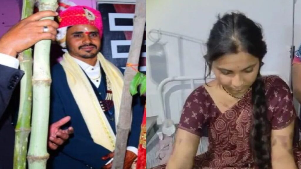 Madhya Pradesh News | Husband Burned His Wife | Dowry Case | Madhya Pradesh Dowry Case | Purchaged 50 times with a hot knife on his wife's body, husband landed on dowry. News Track in Hindi