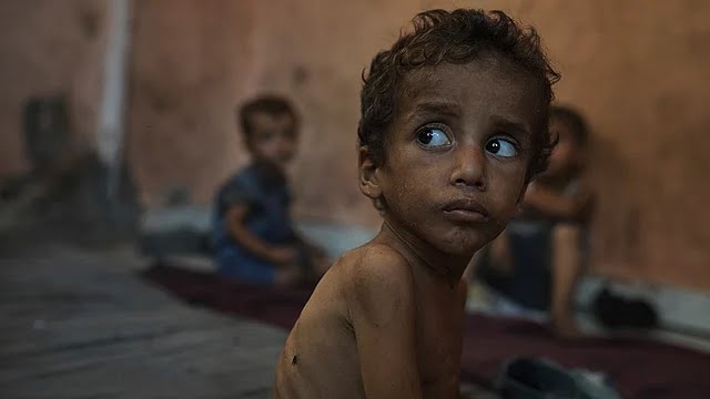 Six countries collapsed in Gaza, Israel told the claims of starvation