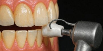 Are you disturbed by yellow teeth? Return pearls in these ways