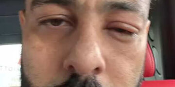 'Avatar ji's punch' ... Emperor with semolina eyes posted pictures on Instagram, fans in worry