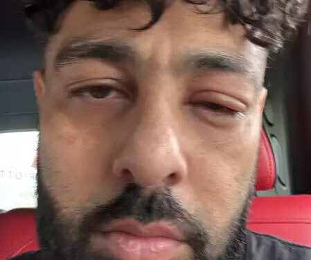 'Avatar ji's punch' ... Emperor with semolina eyes posted pictures on Instagram, fans in worry