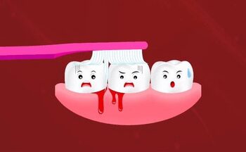 Bleeding from gums is not just oral problem, it is also a gesture towards internal problems of the body