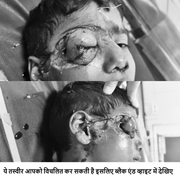Crazy dog ​​terror in Suratpura: Various attack on six -year -old innocent, where are you responsible?