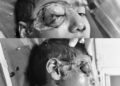 Crazy dog ​​terror in Suratpura: Various attack on six -year -old innocent, where are you responsible?