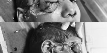 Crazy dog ​​terror in Suratpura: Various attack on six -year -old innocent, where are you responsible?