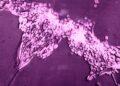 Researchers at ICMR developed a new way of dealing with fungal pathogen