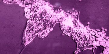 Researchers at ICMR developed a new way of dealing with fungal pathogen