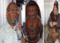 Unique way adopted to leave cigarette, imprisoned face in cage