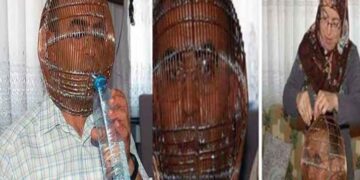 Unique way adopted to leave cigarette, imprisoned face in cage