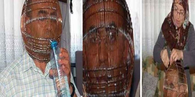 Unique way adopted to leave cigarette, imprisoned face in cage