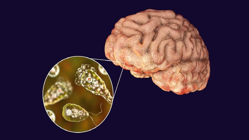 What is brain eating amoeba in hindi: What is brain eating amoeba?