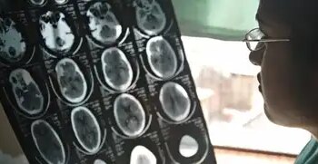 1 out of every 3 people in the world suffers from brain disorder, 11 million people die every year: Report