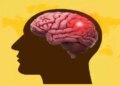 World Stroke Day 2025: Make changes in lifestyle to avoid brain stroke, there will be no problem
