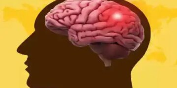 World Stroke Day 2025: Make changes in lifestyle to avoid brain stroke, there will be no problem