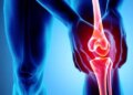 Did knee pain increase after Chikungunya fever? Ayurvedic treatment will provide relief