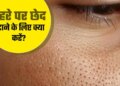 देसी नुस्खे जो कम करेंगे ओपन पोर्स और देंगे चमकदार त्वचा, इस्तेमाल करें रोज और खुद देखें फर्क