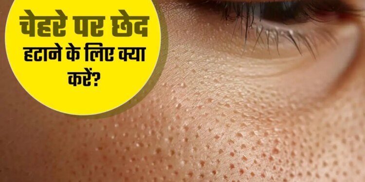 देसी नुस्खे जो कम करेंगे ओपन पोर्स और देंगे चमकदार त्वचा, इस्तेमाल करें रोज और खुद देखें फर्क
