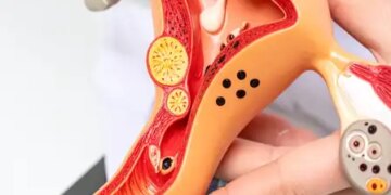 Ignoring the 'female reproductive system' can prove costly, take better care in this way