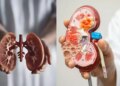 Kidney Damage Signs: सुबह की ये आम आदतें बन रही हैं किडनी खराब होने की सबसे बड़ी वजह, जानें क्या कह रहे हैं एक्सपर्ट्स