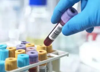 New blood test-based model enabled to predict the risk of severe liver disease