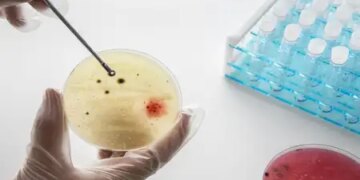 TB patients can get better treatment from steroids, big revelation in the study