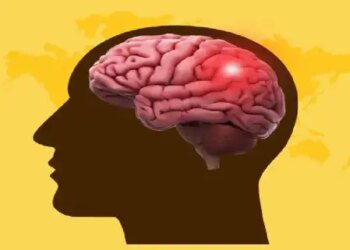 विश्व स्ट्रोक दिवस 2025: ब्रेन स्ट्रोक से बचने के लिए जीवनशैली में करें बदलाव, नहीं होगी परेशानी