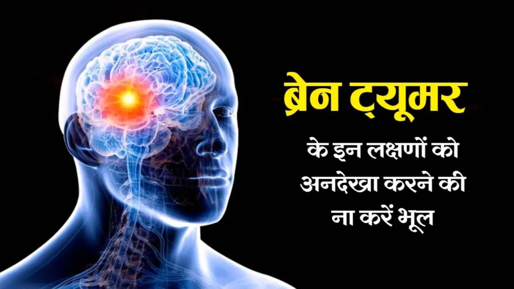 ब्रेन ट्यूमर का शुरुआती चेतावनी संकेत हो सकता है आम सिरदर्द, डॉक्टर ने बताई समय रहते जांच की जरूरी बातें