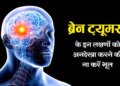 ब्रेन ट्यूमर का शुरुआती चेतावनी संकेत हो सकता है आम सिरदर्द, डॉक्टर ने बताई समय रहते जांच की जरूरी बातें