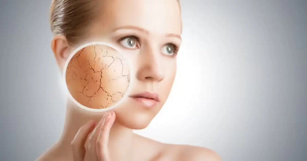 Dry Skin Remedies: सर्दियों में रूखी और खुजली वाली स्किन से चाहिए राहत? अपनाएं ये 5 असरदार घरेलू उपाय