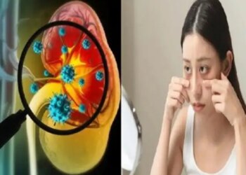 किडनी खराब होने के संकेत: आंखों में नजर आने वाले बदलाव और अन्य चेतावनी लक्षण जिन्हें इग्नोर करना पड़ सकता है भारी&nbsp;