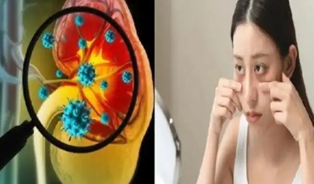 किडनी खराब होने के संकेत: आंखों में नजर आने वाले बदलाव और अन्य चेतावनी लक्षण जिन्हें इग्नोर करना पड़ सकता है भारी&nbsp;