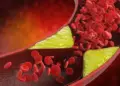 To reduce bad cholesterol, include these 5 things in your diet, you will feel the benefits immediately.