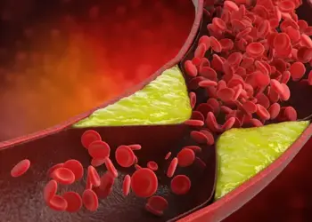To reduce bad cholesterol, include these 5 things in your diet, you will feel the benefits immediately.