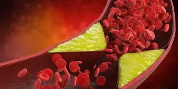 To reduce bad cholesterol, include these 5 things in your diet, you will feel the benefits immediately.