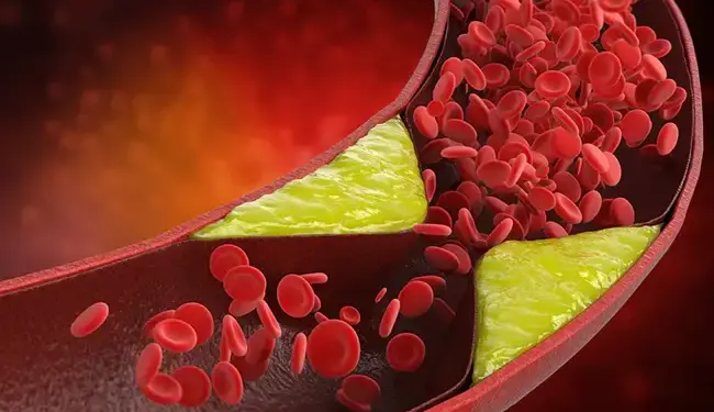 To reduce bad cholesterol, include these 5 things in your diet, you will feel the benefits immediately.