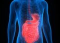 Ulcerative Colitis: The truth hidden in common stomach problems, know the Ayurvedic remedy