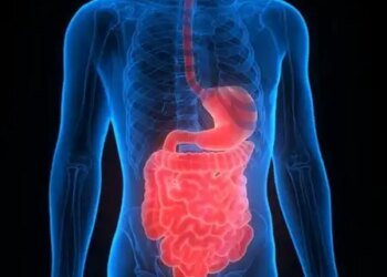 Ulcerative Colitis: The truth hidden in common stomach problems, know the Ayurvedic remedy