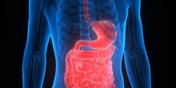 Ulcerative Colitis: The truth hidden in common stomach problems, know the Ayurvedic remedy