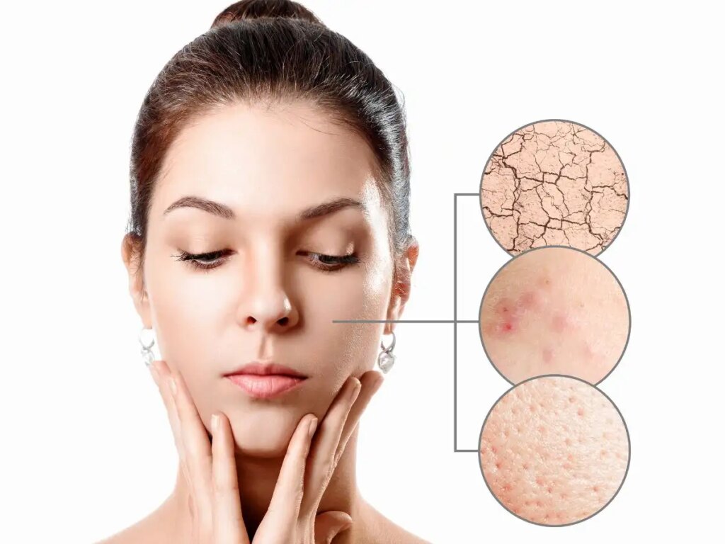 Winter Skin Care: सर्दियों में इन विटामिन की कमी बना रही है त्वचा को रूखा और बेजान, जानें कैसे करें नेचुरल तरीके से स्किन को ग्लोइंग​​​​​​​