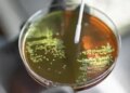 AMR is not only dangerous for the future but also for the present: Expert