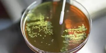 AMR is not only dangerous for the future but also for the present: Expert